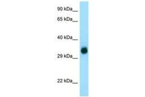 Image no. 1 for anti-gamma-Glutamyl Hydrolase (Conjugase, Folylpolygammaglutamyl Hydrolase) (GGH) (C-Term) antibody (ABIN6749781) (GGH antibody  (C-Term))