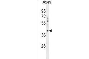 Western Blotting (WB) image for anti-Myosin Binding Protein H-Like (MYBPHL) antibody (ABIN2996396)