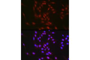 Immunofluorescence analysis of NIH/3T3 cells using RBM14 Rabbit pAb (ABIN6133649, ABIN6146760, ABIN6146762 and ABIN6217049) at dilution of 1:350 (40x lens). (RBM14 antibody  (AA 500-600))