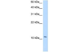 SMPX antibody used at 2. (SMPX antibody  (Middle Region))