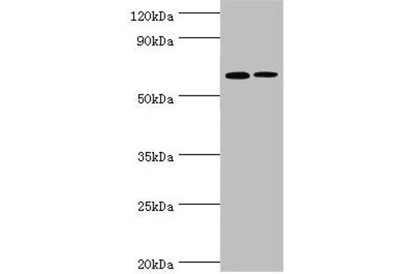 IL27 Receptor alpha antibody  (AA 33-283)