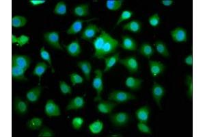 Immunofluorescence staining of A549 cells with ABIN7160623 at 1:166, counter-stained with DAPI. (DMPK antibody  (AA 243-424))