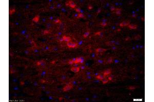 Formalin-fixed and paraffin-embedded rat brain labeled with Rabbit Anti-ATX2 Polyclonal Antibody, Unconjugatedused at 1:200 dilution for 40 minutes at 37°C. (Ataxin 2 antibody  (AA 775-856))