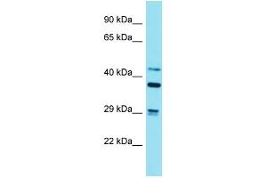 Western Blotting (WB) image for anti-Striatin, Calmodulin Binding Protein 3 (STRN3) (N-Term) antibody (ABIN2789947)