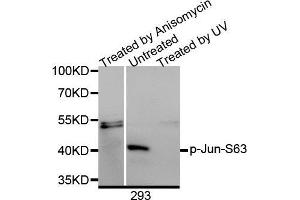 Western Blotting (WB) image for anti-Jun Proto-Oncogene (JUN) (pSer63) antibody (ABIN3023571) (C-JUN antibody  (pSer63))