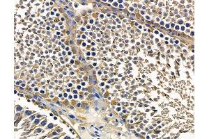 ABIN7096853 and ABIN7100919 at 1/100 staining rat testis tissue by IHC-P.
