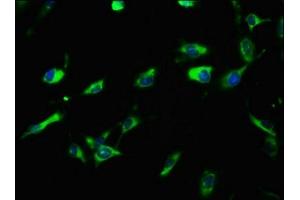 Immunofluorescence staining of U251 cells with ABIN7158211 at 1:100, counter-stained with DAPI. (LRIG3 antibody  (AA 835-985))