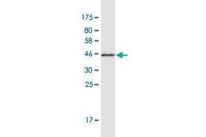 Western Blot detection against Immunogen (44. (NUDCD2 antibody  (AA 1-157))