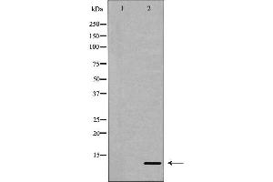 Western blot analysis of extracts of Mouse liver, using IL8 antibody. (IL-8 antibody  (Internal Region))