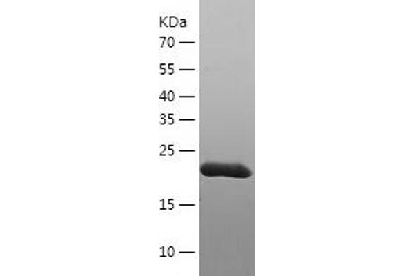 PEX26 Protein (AA 1-246) (His tag)