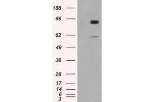 HEK293T cells were transfected with the pCMV6-ENTRY control (Left lane) or pCMV6-ENTRY GBE1 (Right lane) cDNA for 48 hrs and lysed. (GBE1 antibody)