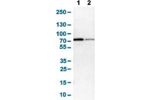 Western Blot analysis of (1) NIH-3T3 cell lysate (Mouse embryonic fibroblast cells), and (2) NBT-II cell lysate (Rat Wistar bladder tumour cells). (Glucose-6-Phosphate Dehydrogenase antibody  (AA 43-154))