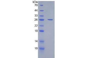 SDS-PAGE analysis of Human CD200 Protein.