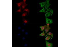 Phospho-JIP1 (Thr205) Antibody staining Hela cells(heat shock treatment) by IF/ICC.