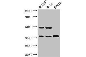 Western Blot Positive WB detected in: HEK293 whole cell lysate, Hela whole cell lysate, Mouse brain tissue All lanes: PPP1CC antibody at 2. (PPP1CC antibody  (Catalytic Subunit))