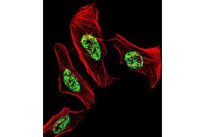Fluorescent confocal image of Hela cell stained with NR2C2 Antibody . (TR4 antibody  (C-Term))