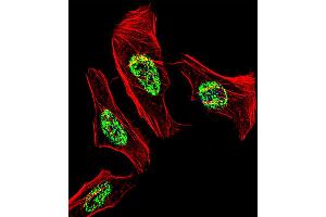 Fluorescent confocal image of Hela cell stained with NR2C2 Antibody .