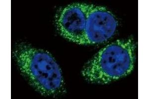Confocal immunofluorescent analysis of TGFB2 antibody with A549 cells followed by Alexa Fluor 488-conjugated goat anti-rabbit lgG (green). (TGFB2 antibody)