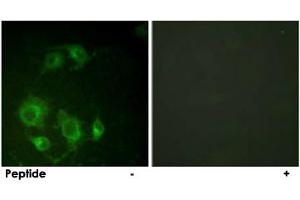 Immunofluorescence analysis of HUVEC cells, using EGFR polyclonal antibody . (EGFR antibody)