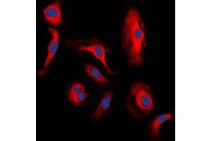 Immunofluorescent analysis of WNT1 staining in H9C2 cells. (WNT1 antibody  (C-Term))