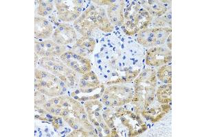Immunohistochemistry (IHC) image for anti-Histone Deacetylase 6 (HDAC6) (AA 1-200) antibody (ABIN3022457)