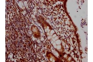 Immunohistochemistry (IHC) image for anti-DEAD (Asp-Glu-Ala-Asp) Box Polypeptide 5 (DDX5) antibody (ABIN7127450)