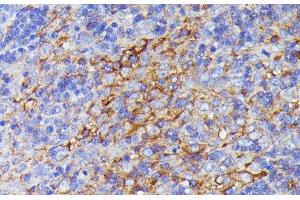 Immunohistochemistry of paraffin-embedded Rat lymph node using SNAP23 Polyclonal Antibody at dilution of 1:100 (40x lens). (SNAP23 antibody)