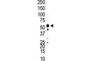 Western blot analysis of JNK2 antibody and Jurkat cell lysate. (JNK2 antibody  (AA 349-379))