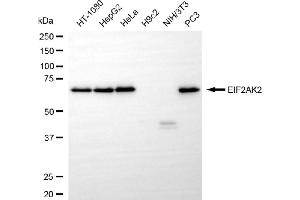 Western blotting analysis using EIF2AK2 antibody (ABIN7798507). (Recombinant EIF2AK2 antibody)