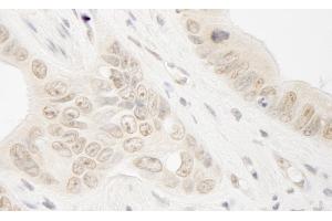 anti-RAD54-Like 2 (RAD54L2) (AA 75-125) antibody