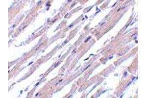 Immunohistochemistry of BCL2L13 in human heart tissue with BCL2L13 polyclonal antibody  at 10 ug/mL . (BCL2L13 antibody  (Internal Region))