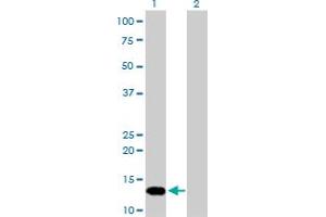 Western Blot analysis of FKBP1A expression in transfected 293T cell line by FKBP1A monoclonal antibody (M01), clone 1E5-A12. (FKBP1A antibody  (AA 1-108))