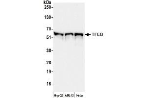 Western Blotting (WB) image for anti-Transcription Factor EB (TFEB) (AA 426-476) antibody (ABIN7450814) (TFEB antibody  (AA 426-476))