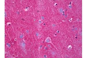 Anti-NDRG4 antibody IHC of human brain, cortex neuropil. (NDRG4 antibody  (AA 1-340))
