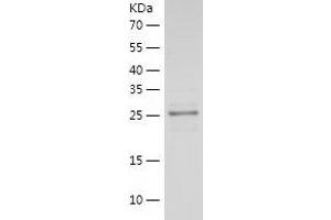 Western Blotting (WB) image for Laminin, alpha 5 (LAMA5) (AA 3401-3692) protein (His tag) (ABIN7284360) (Laminin alpha 5 Protein (AA 3401-3692) (His tag))