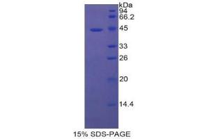 SDS-PAGE (SDS) image for Tryptase alpha/beta 1 (TPSAB1) (AA 161-262) protein (His tag,SUMO Tag) (ABIN1171510)