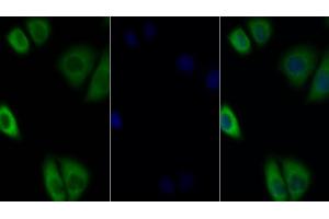 Detection of IL27Ra in Human MCF7 cell using Polyclonal Antibody to Interleukin 27 Receptor Alpha (IL27Ra) (IL27 Receptor alpha antibody  (AA 93-273))
