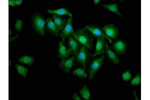 Immunofluorescence staining of A549 cells with ABIN7146942 at 1:200, counter-stained with DAPI. (Caspase 3 antibody  (AA 29-175))