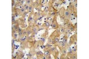 Immunohistochemistry analysis in human liver tissue (Formalin-fixed, Paraffin-embedded) using SPACA5 Antibody , followed by peroxidase conjugation of the secondary antibody and DAB staining. (SPACA5 antibody  (Middle Region))