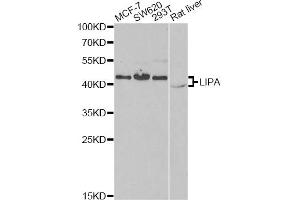 Western blot analysis of extracts of various cell lines, using LIPA antibody. (Lipase A antibody)