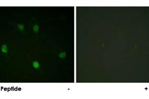 Immunofluorescence analysis of HeLa cells, using CCNE1 polyclonal antibody . (Cyclin E1 antibody)