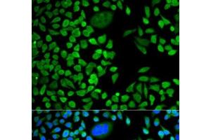 Immunofluorescence analysis of HeLa cells using TIA1 Polyclonal Antibody (TIA1 antibody)