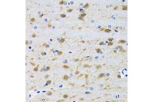 Immunohistochemistry of paraffin-embedded mouse brain using MAPK9 antibody (ABIN5970592) at dilution of 1/100 (40x lens). (JNK2 antibody)