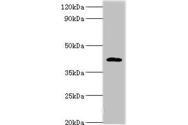 PARL Antikörper  (AA 1-170)