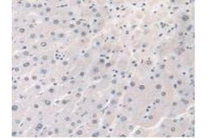 Detection of STX1A in Human Liver Tissue using Polyclonal Antibody to Syntaxin 1A, Brain (STX1A) (STX1A antibody  (AA 1-255))