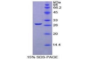 SDS-PAGE (SDS) image for Glutathione S-Transferase mu 1 (GSTM1) (AA 1-220) protein (His tag) (ABIN1079709) (GSTM1 Protein (AA 1-220) (His tag))