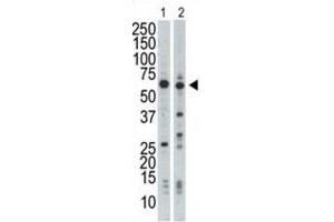 Western Blotting (WB) image for anti-Nuclear Receptor Binding Protein 1 (NRBP1) antibody (ABIN3003671)