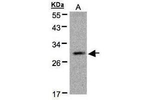 WB Image Sample(30 μg of whole cell lysate) A:MOLT4, 12% SDS PAGE antibody diluted at 1:500 (Kallikrein 2 antibody)