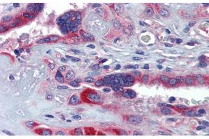 Immunohistochemistry with Human Placenta lysate tissue at an antibody concentration of 5. (GTPBP10 antibody  (Middle Region))