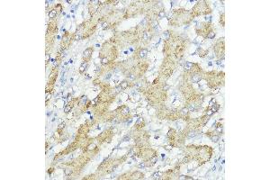 Immunohistochemistry (IHC) image for anti-Suppressor of Cytokine Signaling 6 (SOCS6) (AA 1-210) antibody (ABIN6148273)